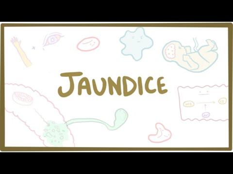 Jaundice - causes, treatment & pathology