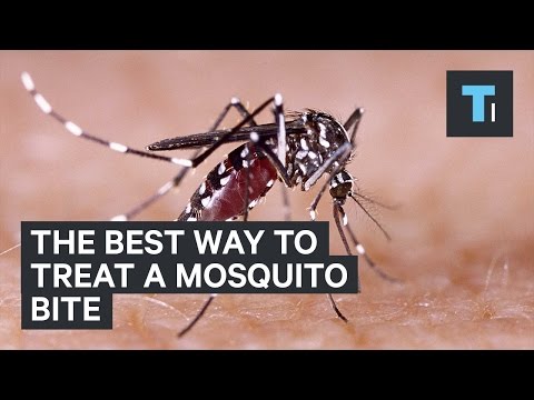 The best way to treat a mosquito bite